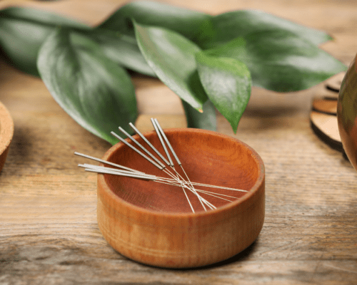 Discovering the Art of Acupuncture: A Path to Holistic Healing