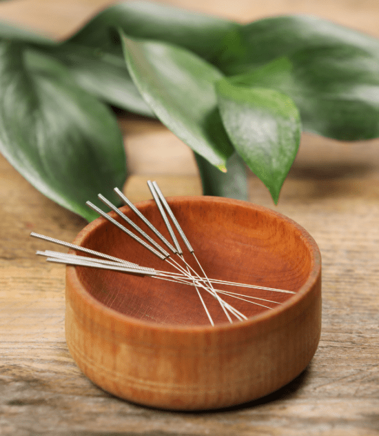 Discovering the Art of Acupuncture: A Path to Holistic Healing